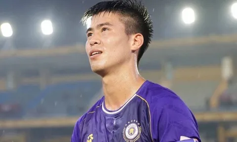 Cầu thủ Duy Mạnh bị mất đồng hồ trị giá hơn 1 tỷ đồng