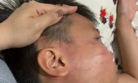 Thầy giáo Ấn Độ bị tố tát học sinh lớp 4 trong lớp học thêm ở Gia Lai